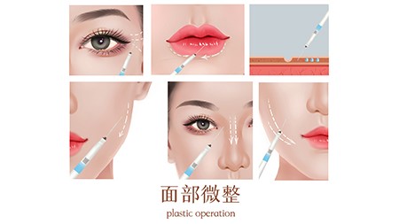 玻尿酸注射隆鼻好吗？有什么优势？